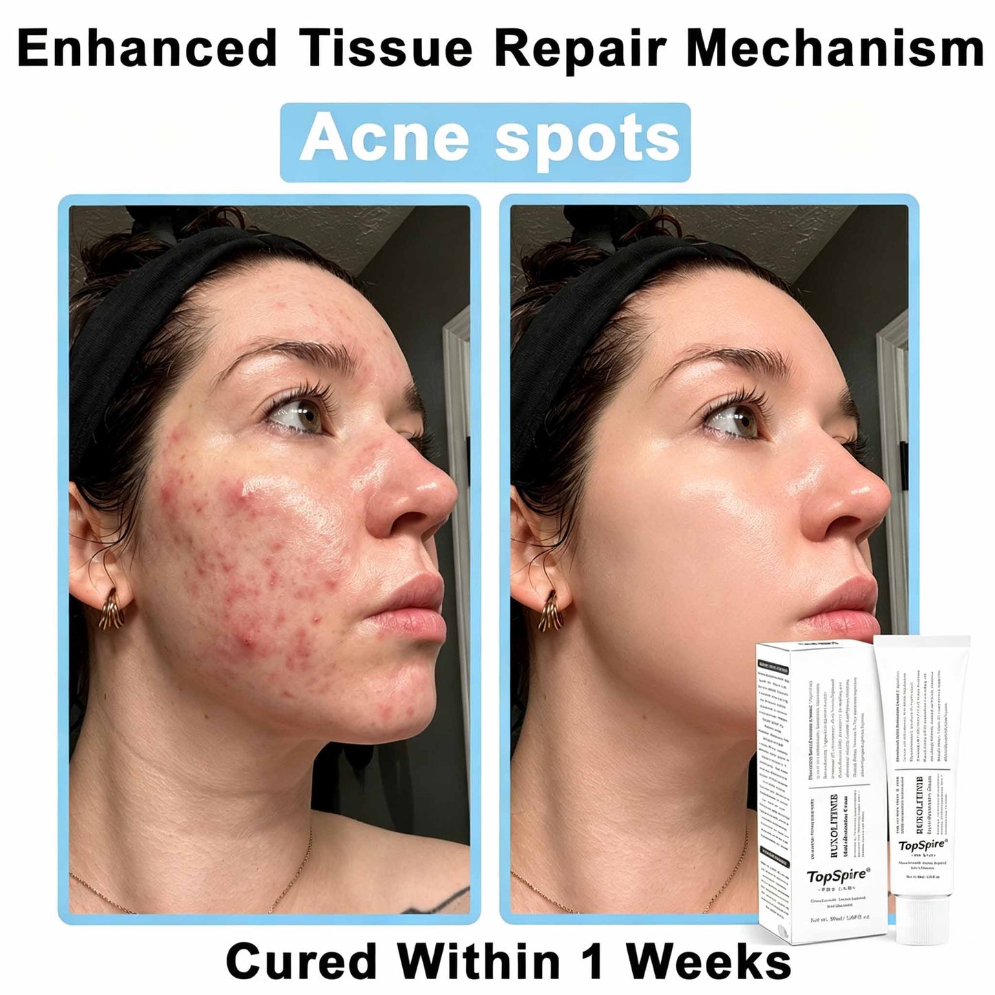 JAK-Smart Repair Cream