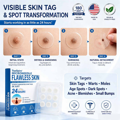 🚩TopSpire®🔥🐟Advanced Microneedle Skin Tag Removal Patch for Fast, Visible Results