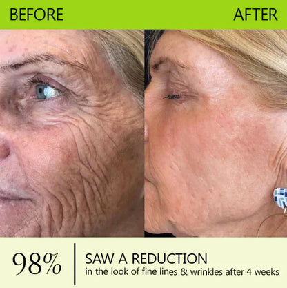 [🔥Last Day 70% OFF]  Eraser for Deep Wrinkles, Sagging Jowls & Puffy Eyes