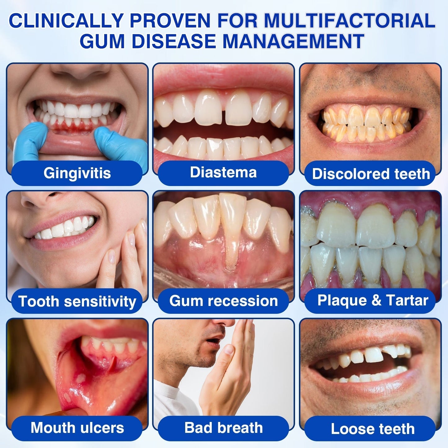 👨‍⚕️🦷🛡️TopSpire® GumRevive Periodontal Repair Gel