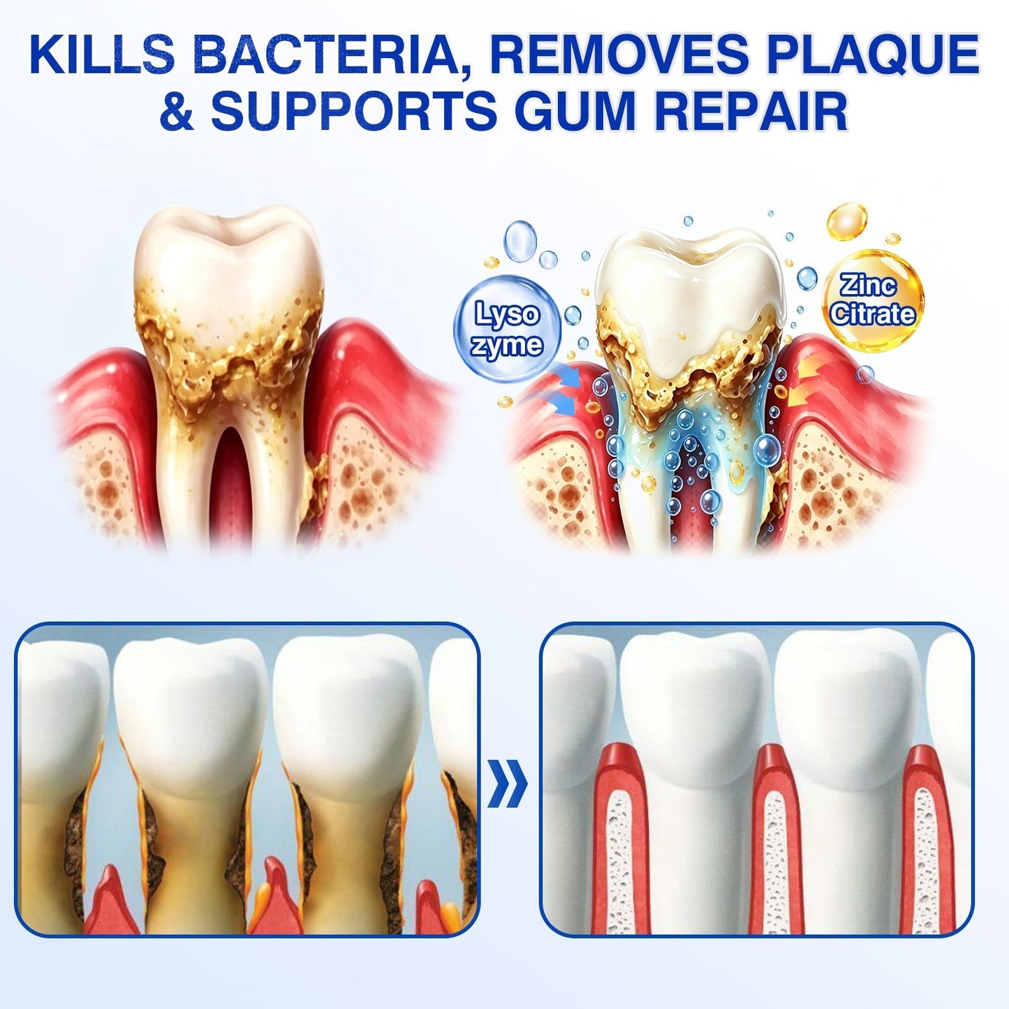 👨‍⚕️🦷🛡️TopSpire® GumRevive Periodontal Repair Gel