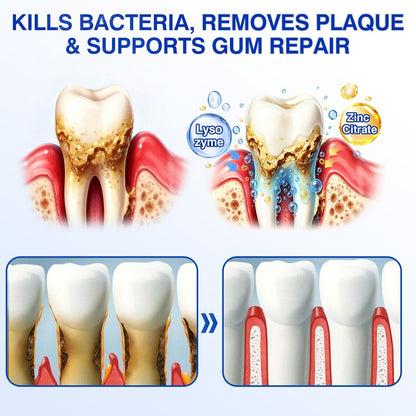 👨‍⚕️🦷🛡️TopSpire® GumRevive Periodontal Repair Gel