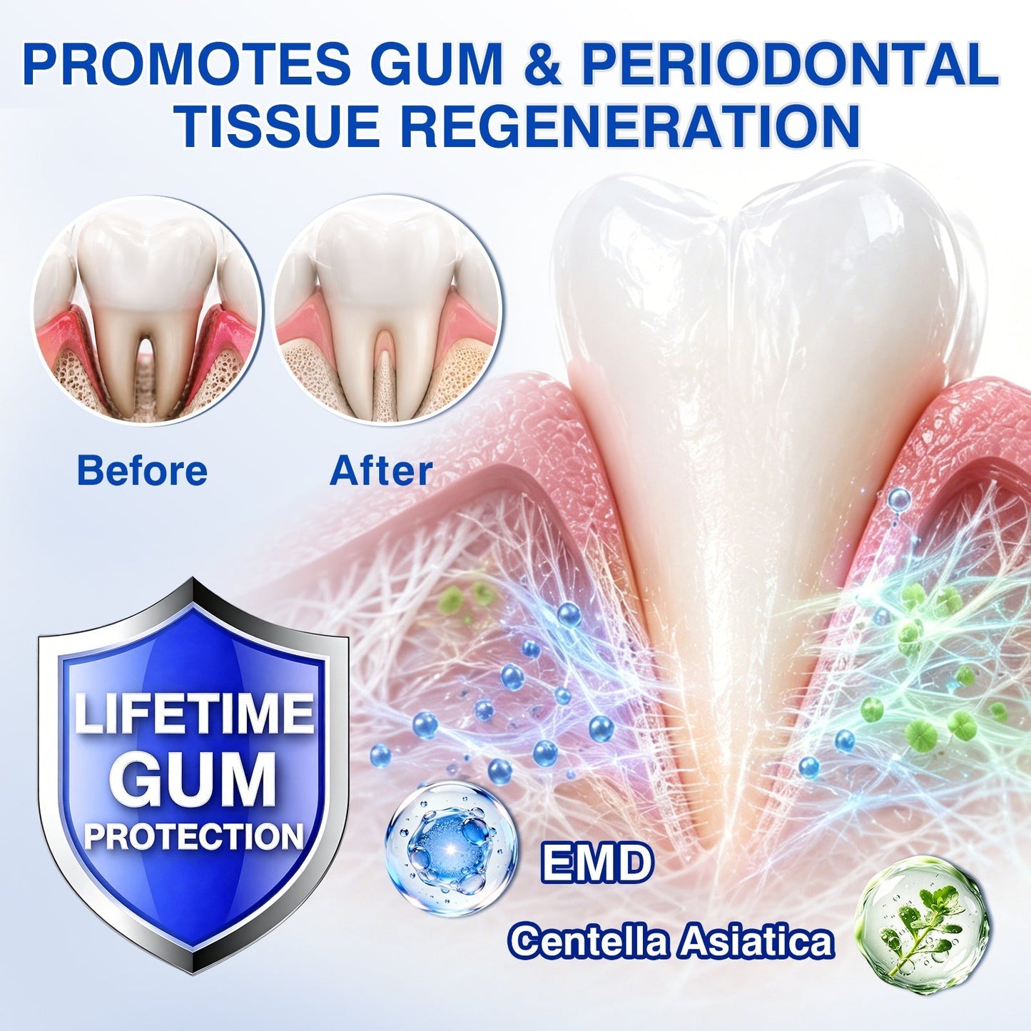 👨‍⚕️🦷🛡️TopSpire® GumRevive Periodontal Repair Gel