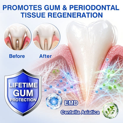 👨‍⚕️🦷🛡️TopSpire® GumRevive Periodontal Repair Gel