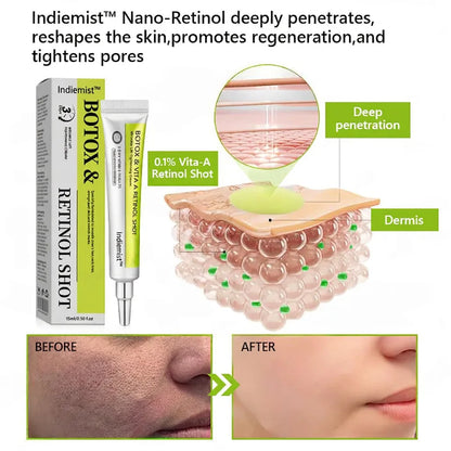[🔥Last Day 70% OFF]  Eraser for Deep Wrinkles, Sagging Jowls & Puffy Eyes