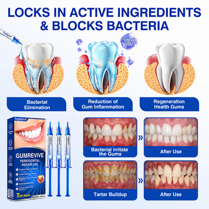 👨‍⚕️🦷🛡️TopSpire® GumRevive Periodontal Repair Gel