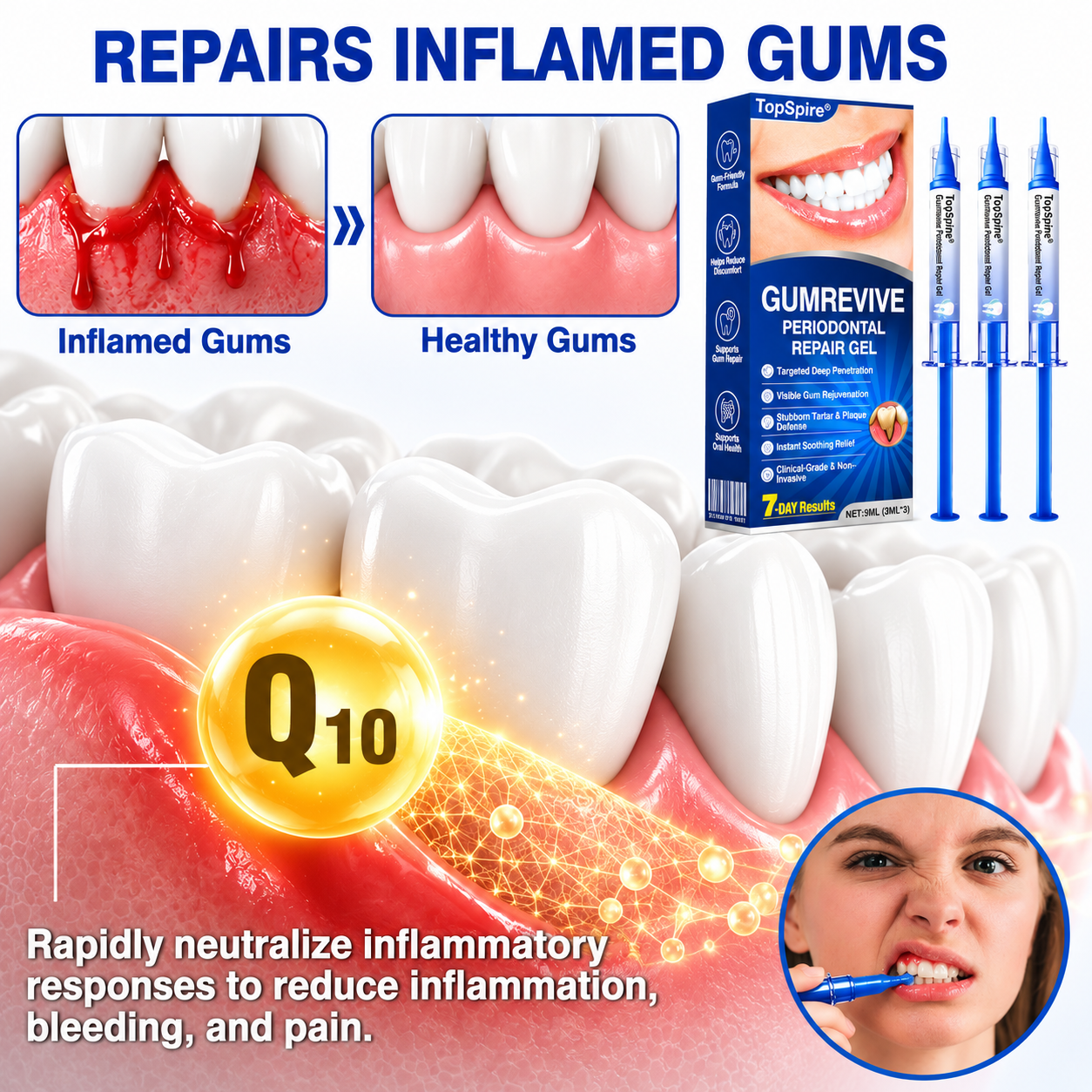 👨‍⚕️🦷🛡️TopSpire® GumRevive Periodontal Repair Gel