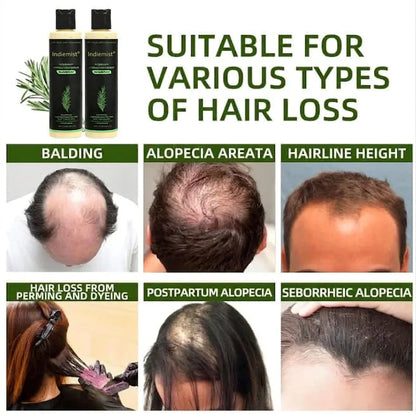 🔥LAST DAY 50% OFF - 🎅Organic Rosemary Hair Growth Shampoo