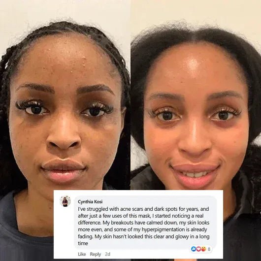 🌙✨ Indiemist™ Overnight Collagen Mask | Firm • Hydrate • Brighten While You Sleep