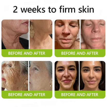 [🔥Last Day 70% OFF]  Eraser for Deep Wrinkles, Sagging Jowls & Puffy Eyes