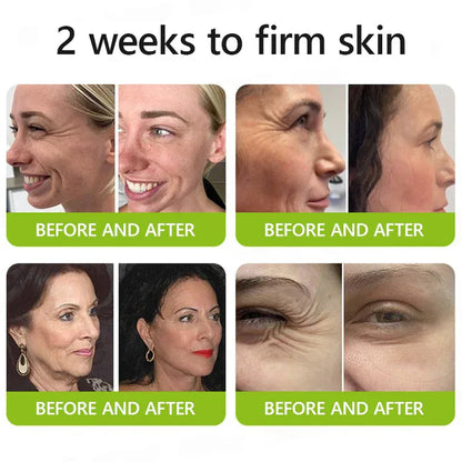 [🔥Last Day 70% OFF]  Eraser for Deep Wrinkles, Sagging Jowls & Puffy Eyes