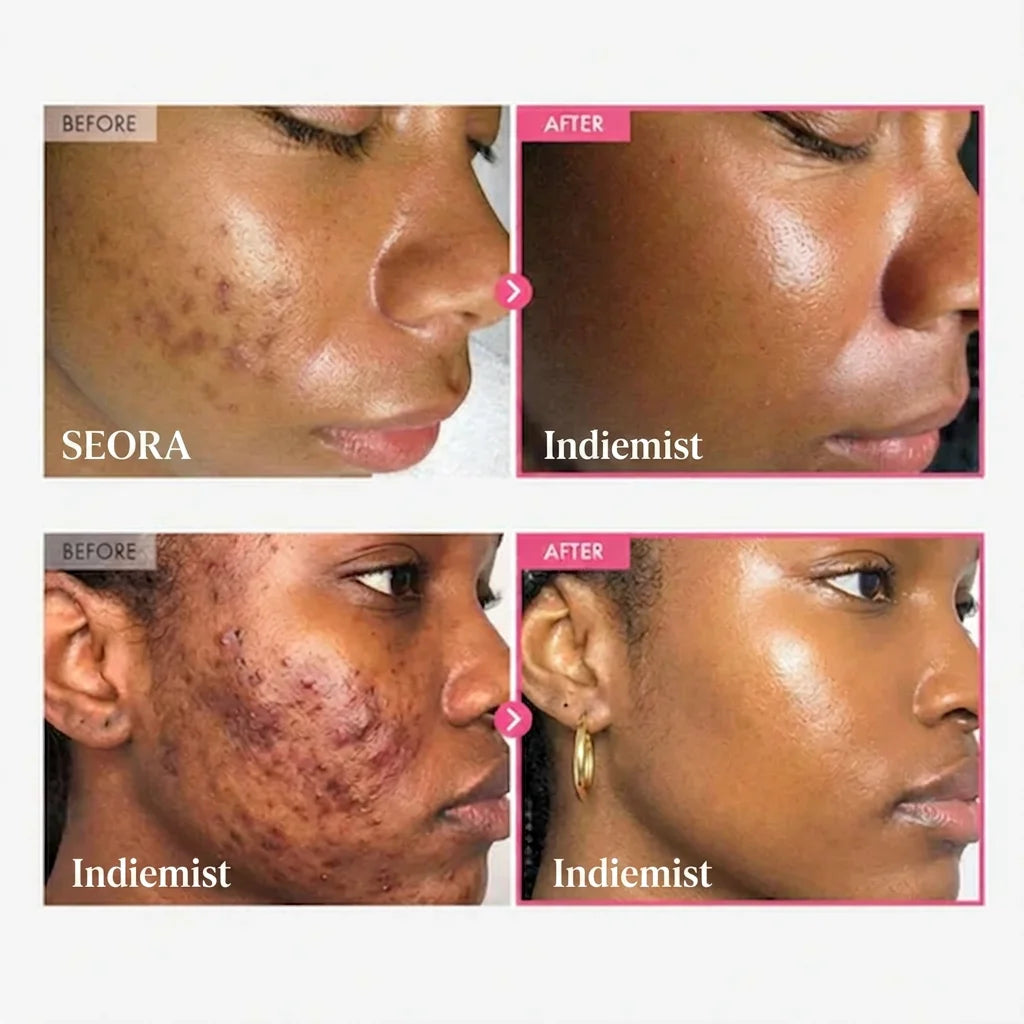 ✨🌸 Indiemist™ Alpha Arbutin + TXA Cream — Your Daily Brightening Essential