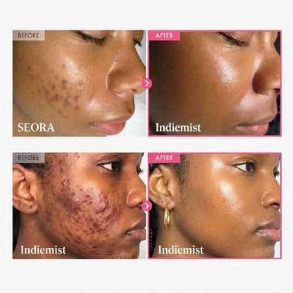 ✨🌸 Indiemist™ Alpha Arbutin + TXA Cream — Your Daily Brightening Essential