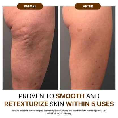 🌿 Indiemist® Silk Body Oil  Reveal Firmer, Smoother & Radiant Skin
