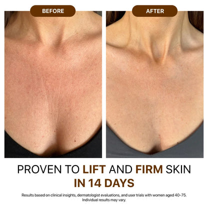 🌿 Indiemist® Silk Body Oil  Reveal Firmer, Smoother & Radiant Skin