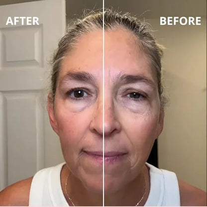 ✨ Indiemist™ Miracle Face Sculptor: Instant V-Shape Lift & Youthful Glow! 💖