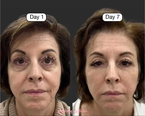 ✨ Indiemist™ Miracle Face Sculptor: Instant V-Shape Lift & Youthful Glow! 💖
